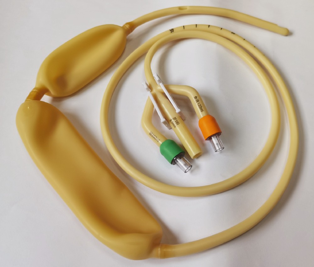 在肝胆胃肠科,三腔二囊管治疗肝硬化有效吗