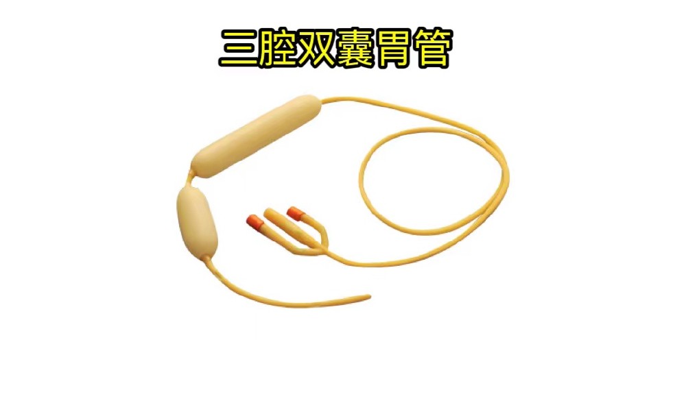 从治疗到监测，三腔双囊胃管如何助力胃肠健康管理