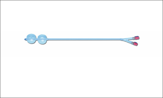 孕产安全无小事，子宫颈扩张球囊导管超可靠